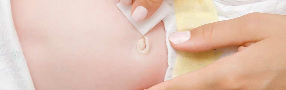 Pupčana kila kod beba – zašto nastaje i kako je tretirati