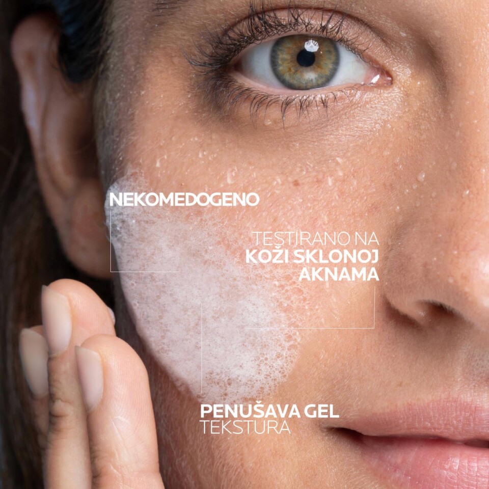 Nekomedogena penušava gel tekstura testirana na koži sklonoj aknama