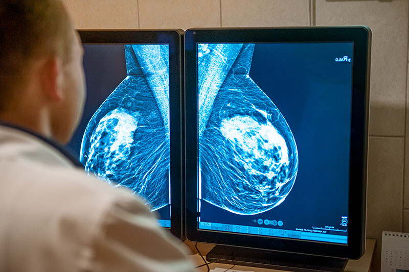 mamografija-inner